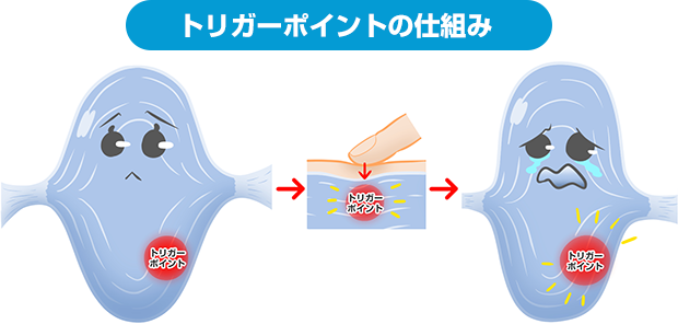 トリガーポイントの仕組み