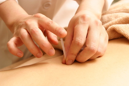 トリガーポイント針治療